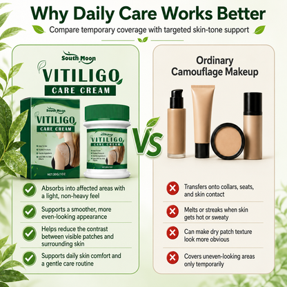 Ceoerty® Herbal Vitiligo Cream