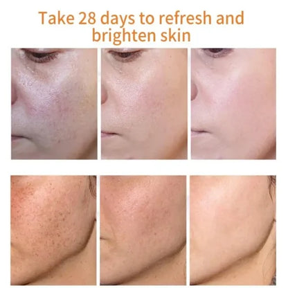 LUNOON™ Blemish Removing Beauty Cream