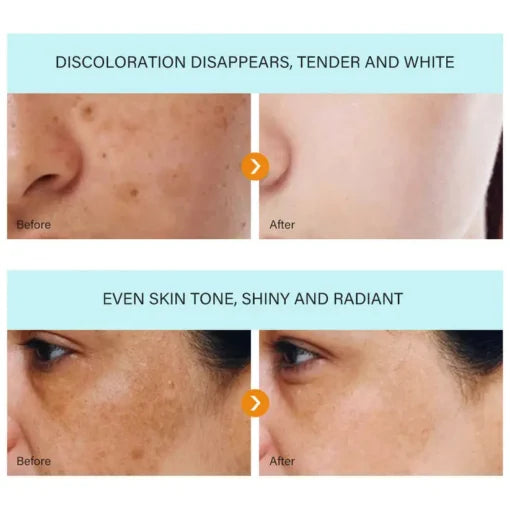 LUNOON™ Blemish Removing Beauty Cream