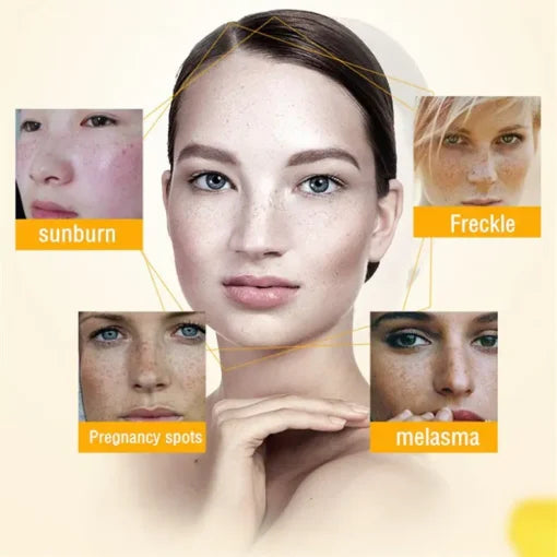 LUNOON™ Blemish Removing Beauty Cream
