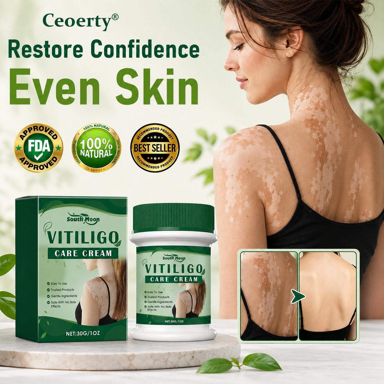 Ceoerty® Herbal Vitiligo Cream
