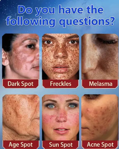 LUNOON™ Blemish Removing Beauty Cream