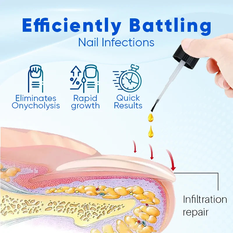 Biancat® OnyxoGuard Nail Growth and Repair Serum