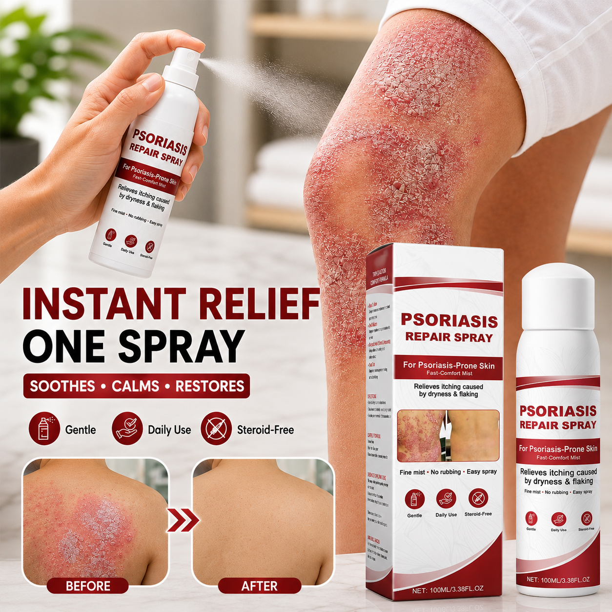 KUBOZN® Beef Tallow Spray for Itchy, Flaky Psoriasis Skin