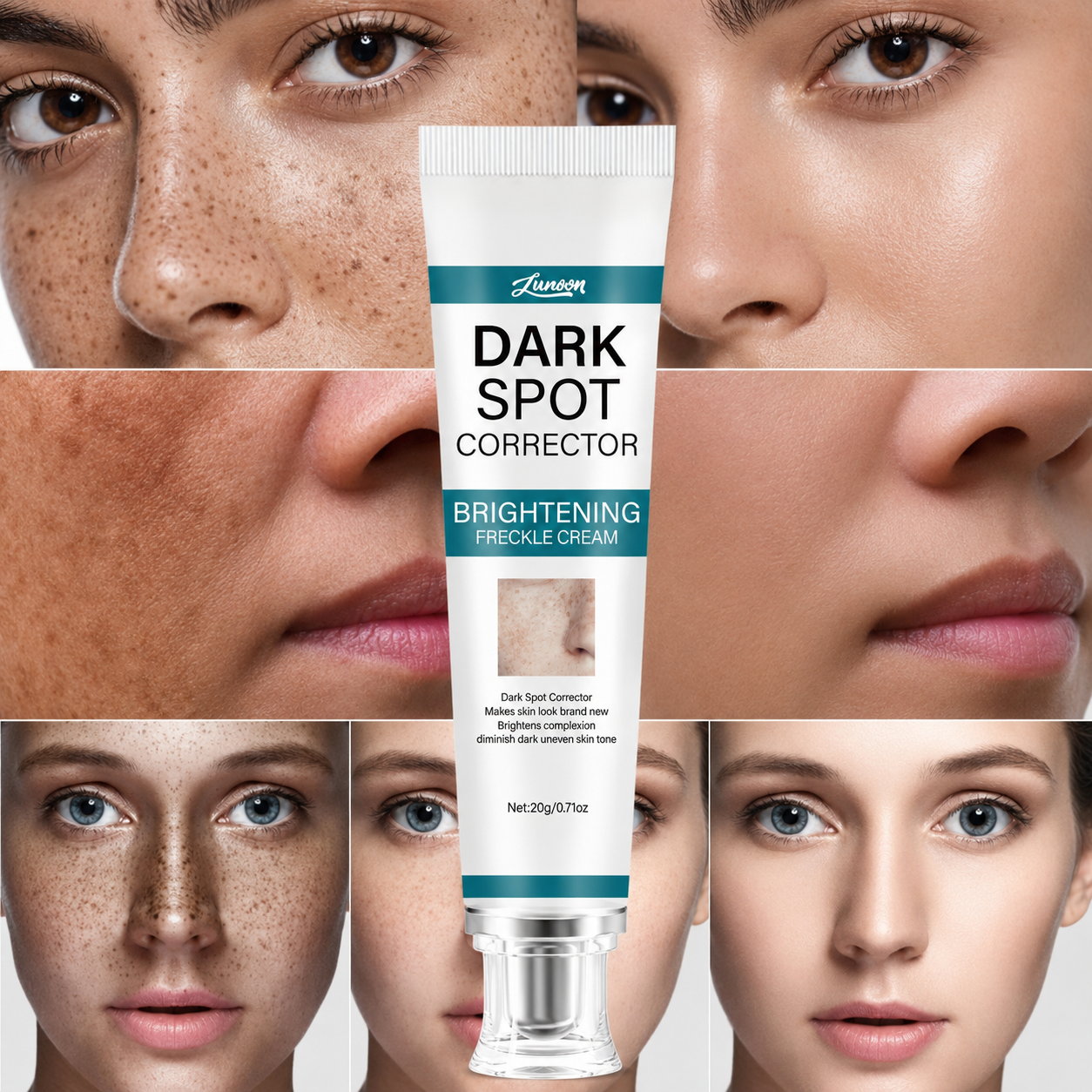 LUNOON™ Blemish Removing Beauty Cream