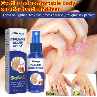 South Moon® PsoriaMucin No-Rub Itch & Flake Relief Mist