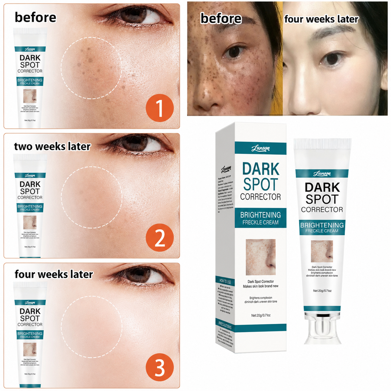 LUNOON™ Blemish Removing Beauty Cream