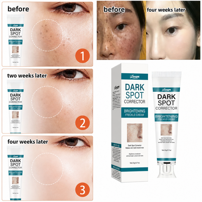 LUNOON™ Blemish Removing Beauty Cream
