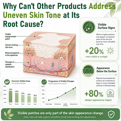 Ceoerty® Herbal Vitiligo Cream