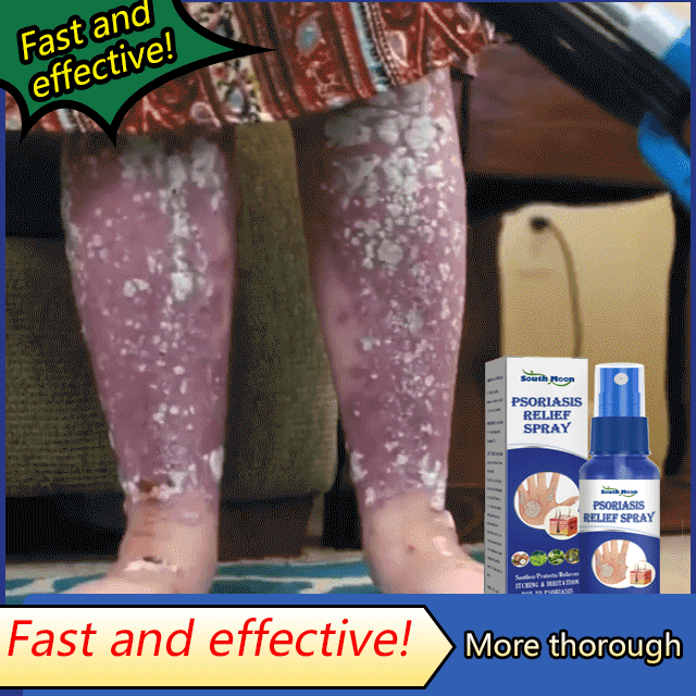 South Moon® PsoriaMucin No-Rub Itch & Flake Relief Mist