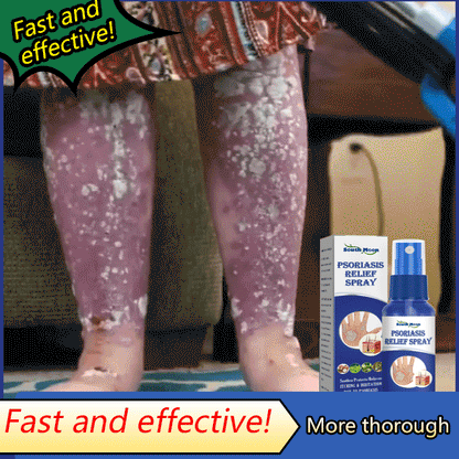 South Moon® PsoriaMucin No-Rub Itch & Flake Relief Mist