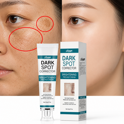 LUNOON™ Blemish Removing Beauty Cream