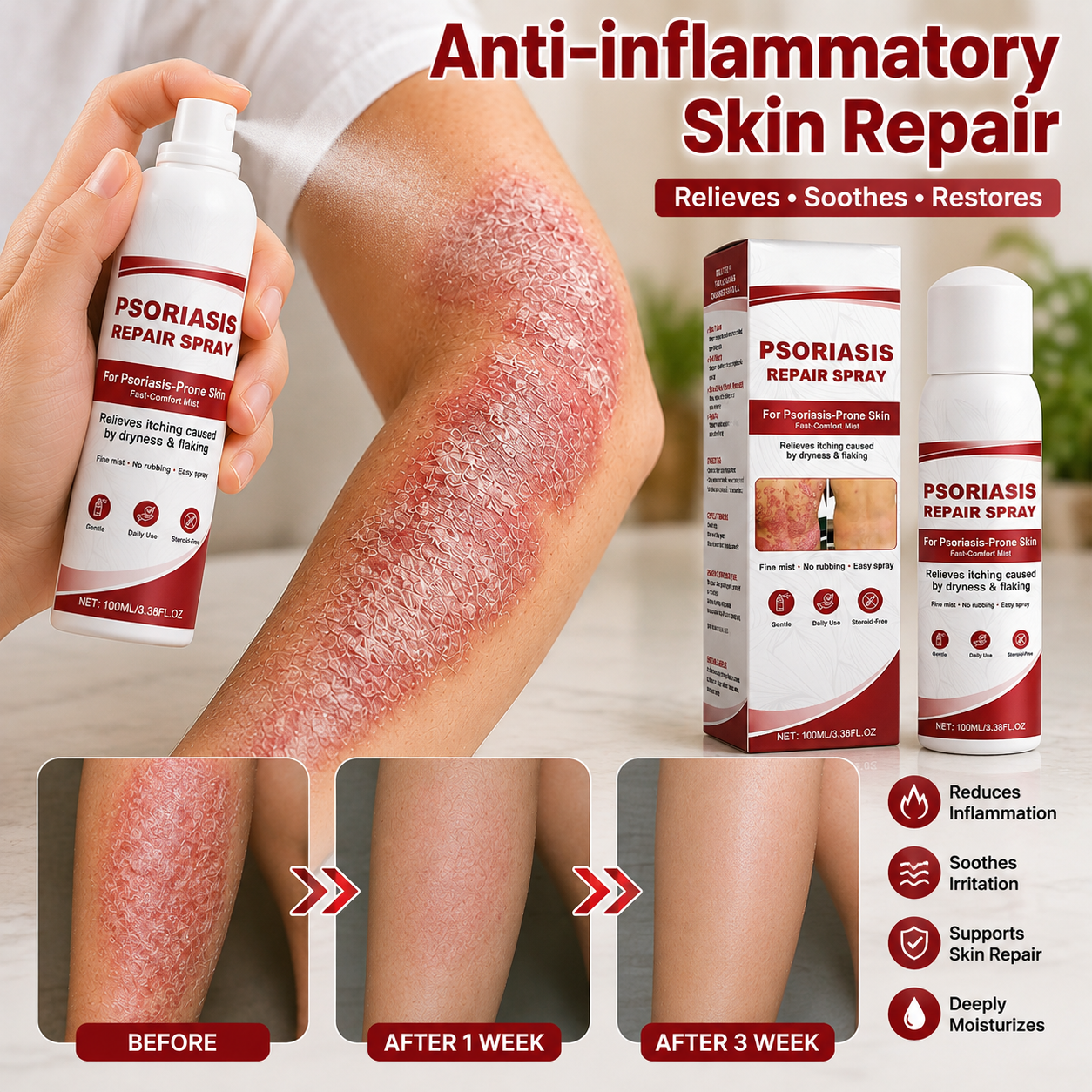 KUBOZN® Beef Tallow Spray for Itchy, Flaky Psoriasis Skin