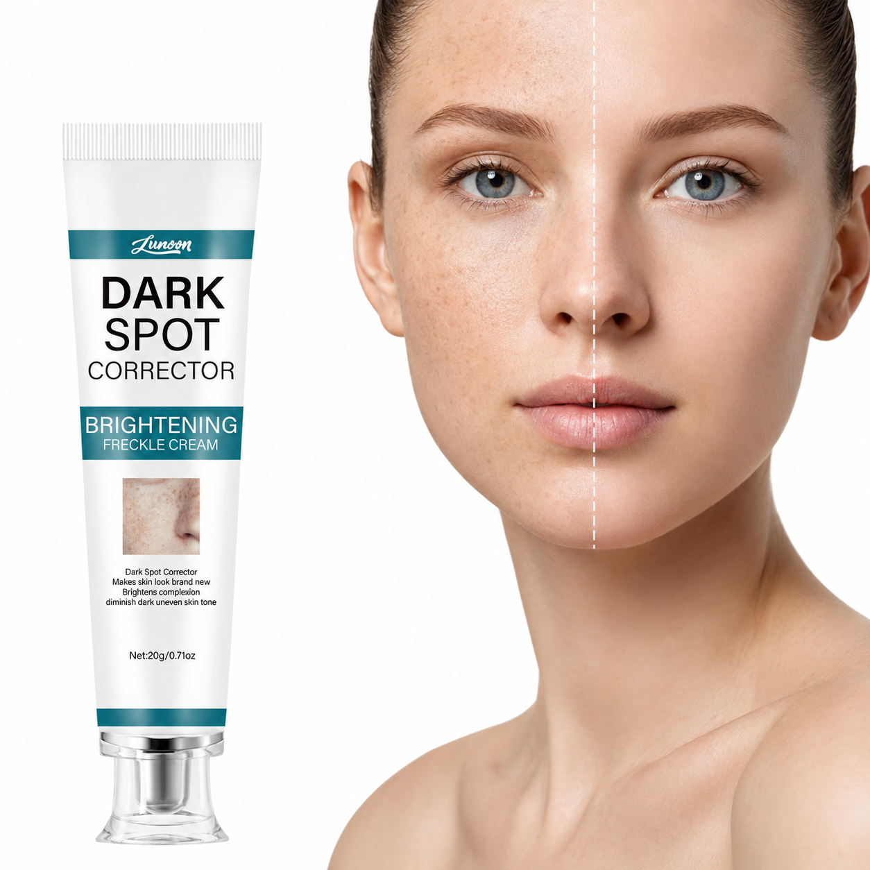 LUNOON™ Blemish Removing Beauty Cream