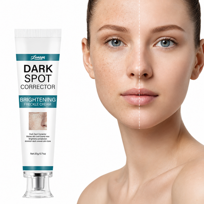 LUNOON™ Blemish Removing Beauty Cream