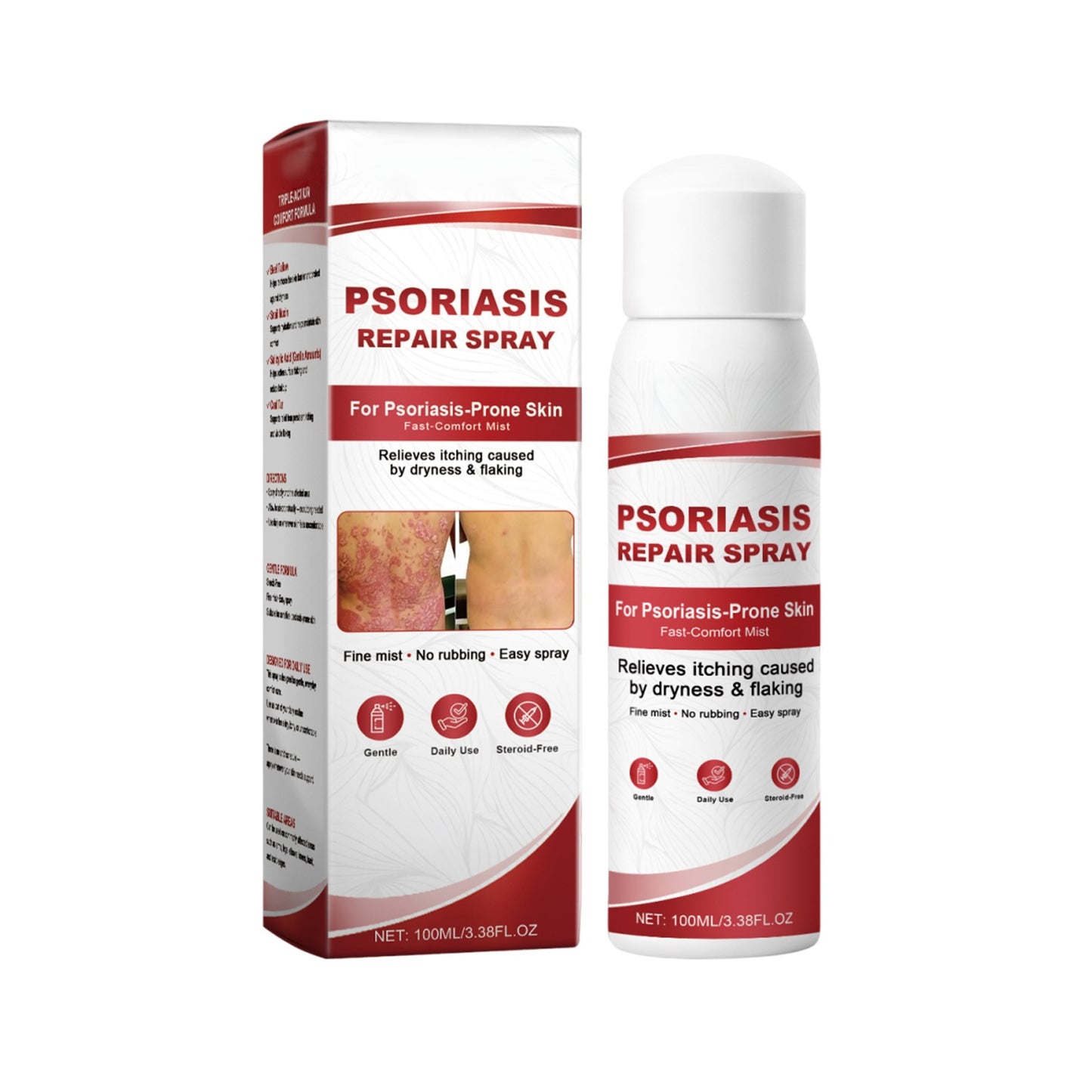 KUBOZN® Beef Tallow Spray for Itchy, Flaky Psoriasis Skin