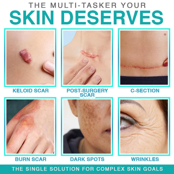 CareBreeze® 3-in-1 Scar Removal Microneedle Care Patch 💡