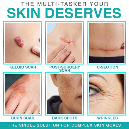 CareBreeze® 3-in-1 Scar Removal Microneedle Care Patch 💡