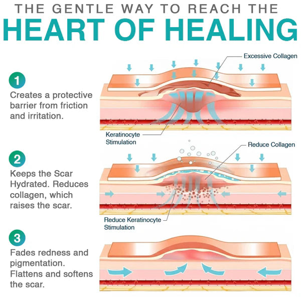 CareBreeze® 3-in-1 Scar Removal Microneedle Care Patch 💡