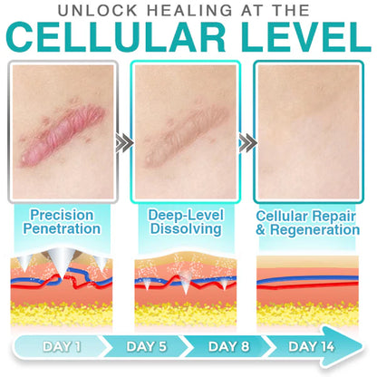 CareBreeze® 3-in-1 Scar Removal Microneedle Care Patch 💡