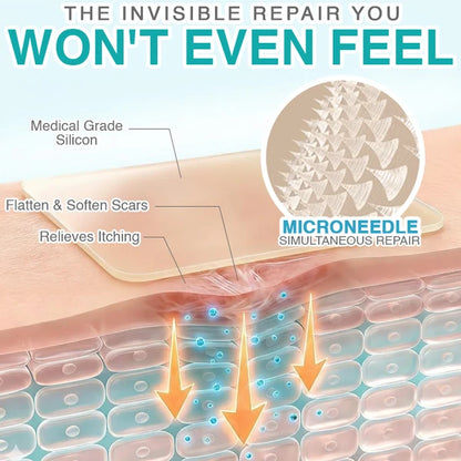 CareBreeze® 3-in-1 Scar Removal Microneedle Care Patch 💡