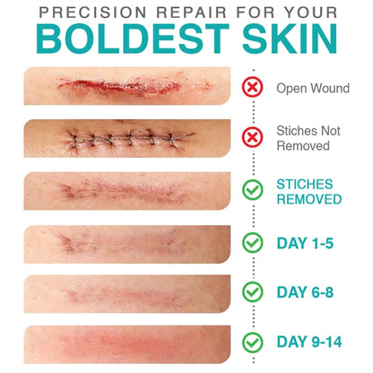 CareBreeze® 3-in-1 Scar Removal Microneedle Care Patch 💡